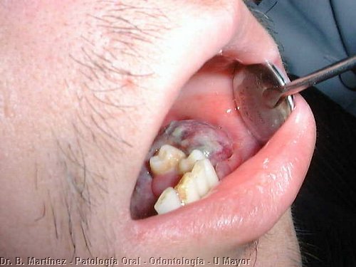 Fig. 1.2 Vista intraoral,
