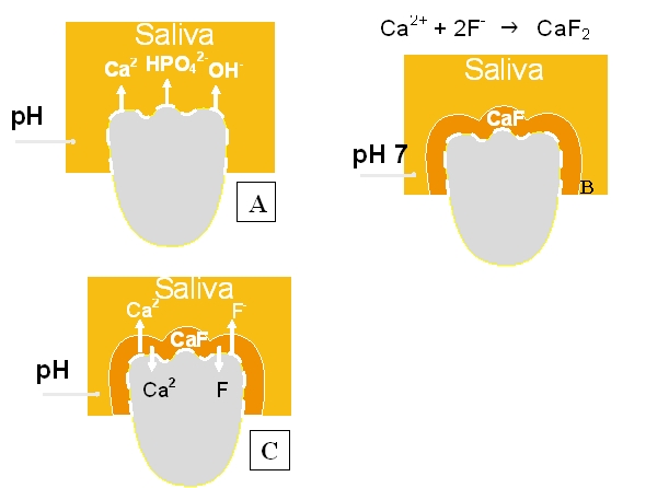 Fig. 1. A) Desmineralización sin fluoruros. B) Capa protectora de fluoruro de calcio. C) Disponibilidad biológica de fluoruros. (Kurth A. Clases teóricas. Curso Cariología 2008, Fac. Odontología, U. Mayor.)
