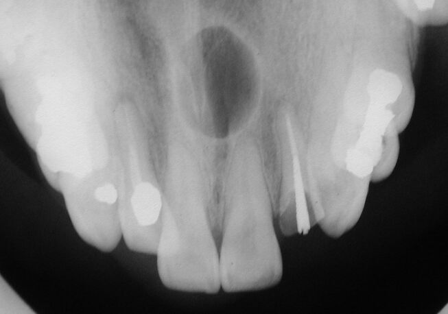 qnasopalarx10_02.jpg